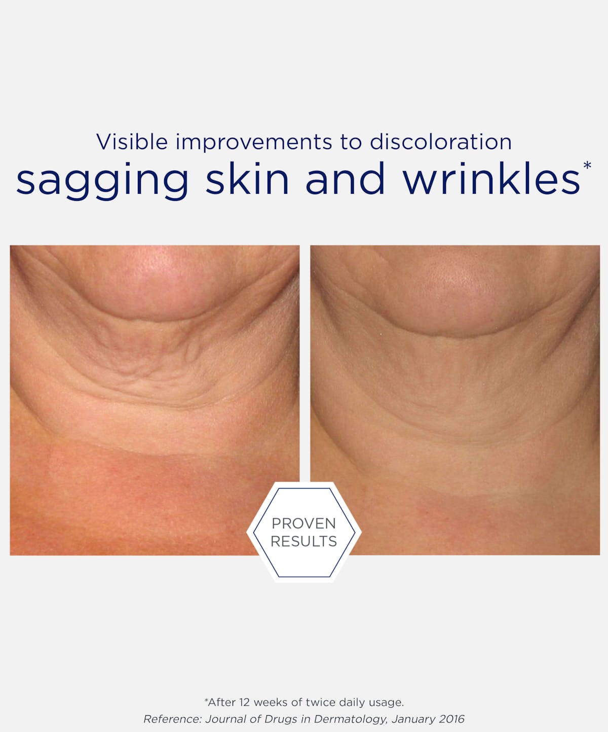 Triple Firming Neck Cream