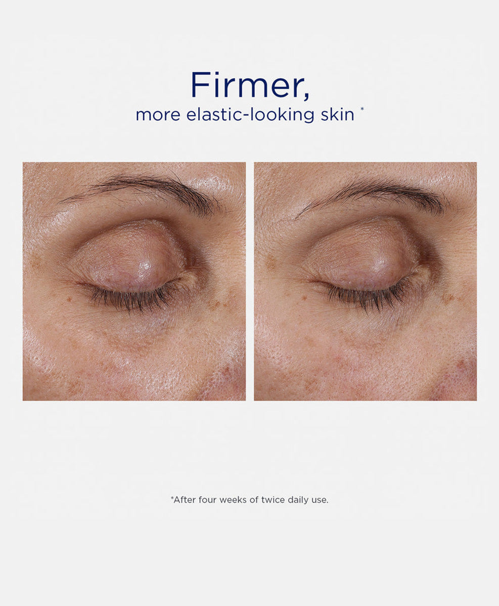 Intensive Eye Therapy